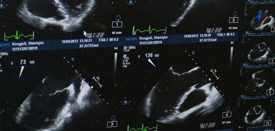 Darstellung eines Ultraschall-Fotos